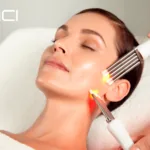 caci jowl lift addlestone