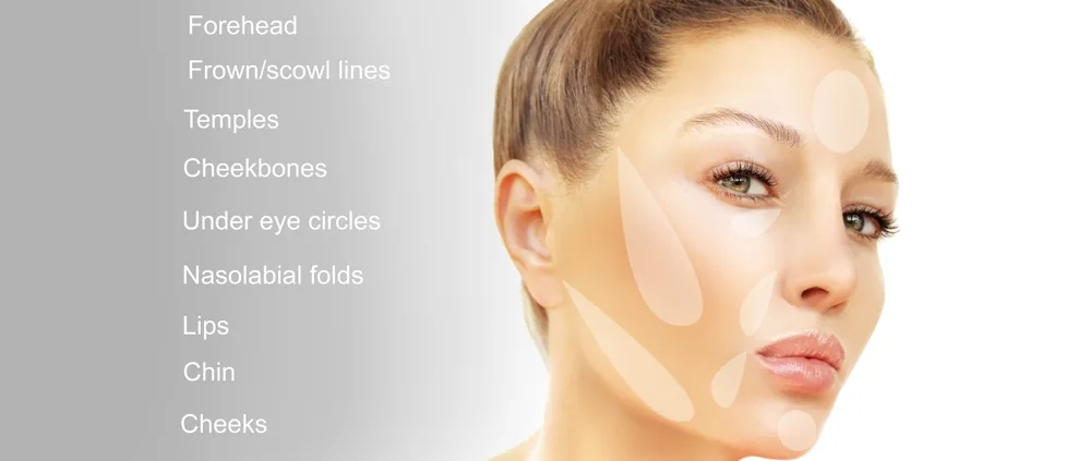 Dermal Fillers at Addlestone Therapy, Addlestone