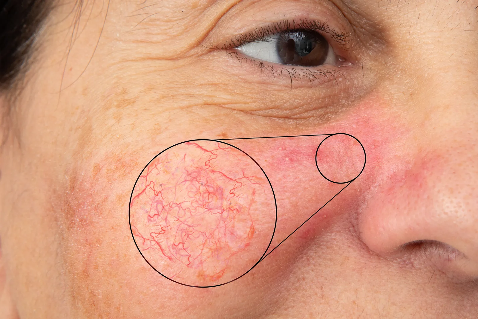 Advanced Cosmetic Procedures at Addlestone Therapy in Addlestone, Surrey