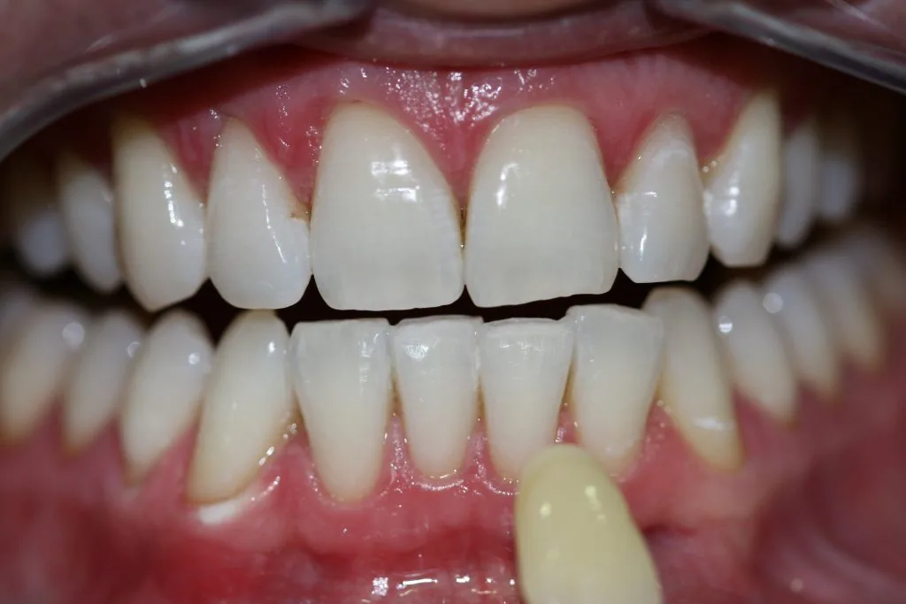 After at Addlestone Therapy, Addlestone