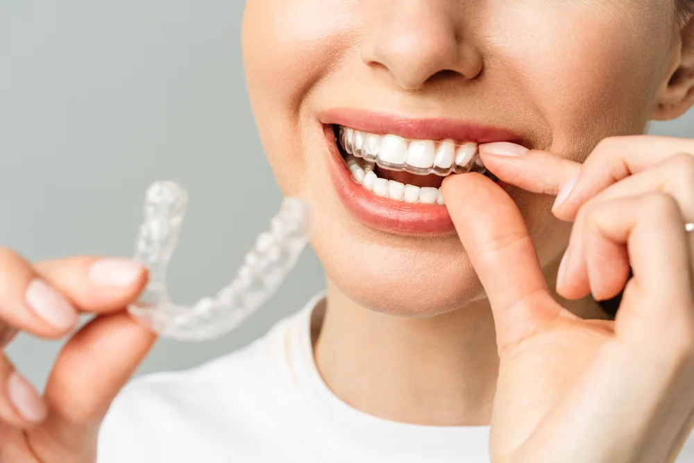 Teeth Whitening at Addlestone Therapy in Addlestone, Surrey