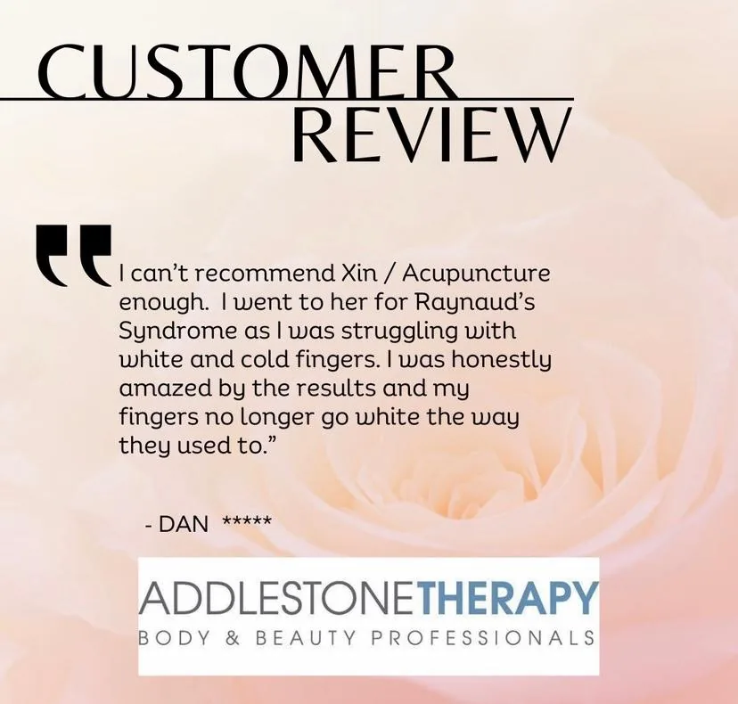 Acupuncture for General Wellbeing at Addlestone Therapy, Addlestone